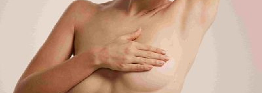 Lo que debes saber del levantamiento de mamas